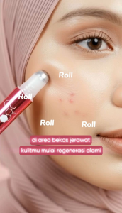 🆕💯% ORIGINAL Glowtech Spicule Rejuvenation DRW SKINCARE