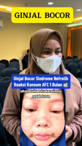 Supplement Kesehatan Jepang S** Suba untuk stroke autoimun