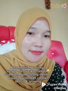 [ORLIN BEAUTY]KRIM SIANG MALAM FLEK MENYAMARKAN NODA HITAM/KRIM FLEK/ORLIN FLEK/ORLIN SKINCARE VIRAL