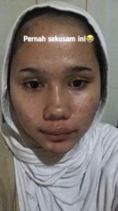 SKINTIFIC MSH Niacinamide Brightening Moisture Gel - Pelembab Wajah Skintific