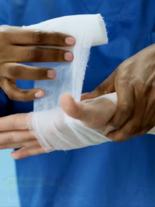 BIOCHANNA Extrak Ikan Gabus Kaya Albumin Mempercepat Penyembuhan