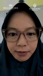 glamoure beauty malam whitening express ORIGINAL UNTUK FLEK MEMBANDEL BERUNTUSAN BEKAS JERAWAT DLL