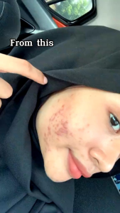 CHEWABLE CANDY KWHITE BOOSTER🔥 DRACOBELLE EXTRAK WHITE BLACKCURRENT FLOVOUR🔥TABLET KUNYAH PUTIH 1 BADAN🔥ORI By WHITE PINKISH