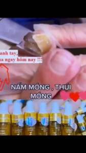 Serum Lành Nấm Móng Hư Bọng Nước Ăn Móng Khoé Tay Chân