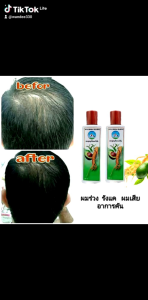 HERBAL ANTIBALD SHAMPOO อะโปโล แชมพูสมุนไพร