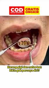 Pemutih Gigi Baking Soda & Penghilang Plak Gigi dengan Natural Essence