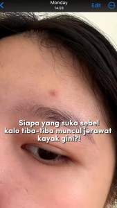 Home peeling Benings skincare