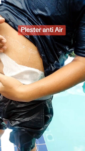 Plester Transparan Anti Air! Mandi Tetap Aman Luka Tetap Kering