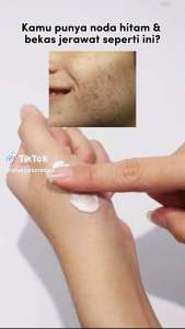 Viva whitening cream 15ml penghilang flek bekas jerawat Dyshop22