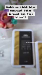 ANZORA BEDAK PADAT ANZORA BEDAK ANZORA TWO WAY CAKE ANZORA CUSHION ANZORA BEDAK TABUR ANZORA LIP SERUM ANZORA SERUM ANZORA SERUM DNA SALMON ANZORA TOTOL ACNE ANZORA SERUM MUTIARA ANZORA NIGHT CREAM ANZORA MASKER ANZORA ANZORA SKINCARE ANZORA GARUT KOTA