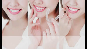 JAYSUING RETAINER CLEANER tablet pembersih gigi palsu pemutih gigi palsu penghilang bau gigi