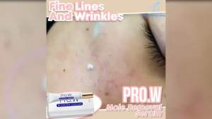 PRO.W BLEMISH CREAM Penghilang  Jeragat Bintik hitam black spot Sunburn melasma melanin