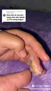 TUMITKU 30ML KAKI PECAH obat ampuh untuk menghilangkan kulit mati / KAPALAN DI KAKI