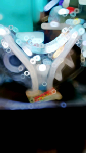 Lampu Depan Honda Vario 110 Karbu Custom Projie Sein Running