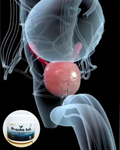 Teh Prostat membantu sembuhkan kanker prostat tanpa operasi