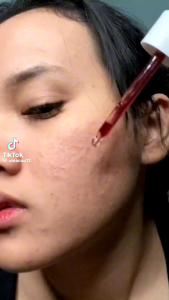 ❤️Mimio❤️ELFORMULA Intensive Peeling Solution for Exfoliating 35ml