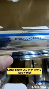InnoQ Ultrasound Paper High Glossy 110 mm x 18 m Kertas USG kualitas Sony UPP 110HG