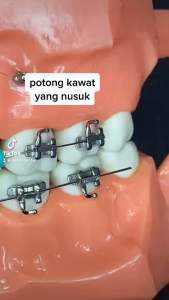 ANTI KARAT TANG POTONG KAWAT BEHEL MINI / PEMOTONG KAWAT NITI BRACKET GIGI / DISTAL CUT BEHELLDENTAL