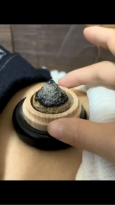 Set Miếng Đệm Ngọc Xông Ngải Cứu Giải Lạnh Bụng Bộ Miếng Ngọc Hơi Rốn Kèm vỉ 20 Tháp nhang Ngải Cứu Cải Thiện Lạnh Bụng