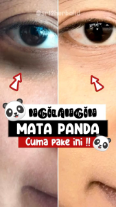 REVATILIZING SERUM SR12 - ATASI MATA PANDA - ATASI BOPENG - ATASI LINGKARAN HITAM MATA - MENCERAHKAN KULIT - MELEMBABKAN - MENGECILKAN PORI-PORI