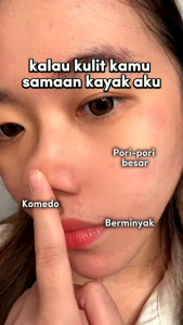 Eileen Grace Perfectly Moisturize Rose Jelly Mask & Eileen Grace Perfectly White Reveal Deep Metabolism Black Jelly Mask (tanpa kotak)