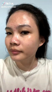 Hanasui Peeling Power Serum | Eksfoliasi Wajah | Mencerahkan | Angkat Sel Kulit Mati Komedo