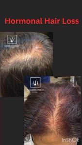NANO HAIR GROWTH CLINIC Hair Growth Tonic
