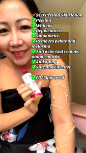 SCD Peeling Lotion 100ml and 50ml