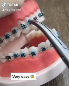 GUNTING HEMOSTAT ALAT GANTI PASANG KARET BEHEL POWER O CHAIN TARIK SAMBUNG - ARTERI KLEM MOSQUITO