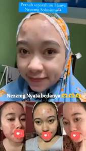 (KEMASAN BARU)CREAM NEZZMG SKINCARE REGULLER ACNE UNTUK KULIT BRUNTUS DAN JERAWAT