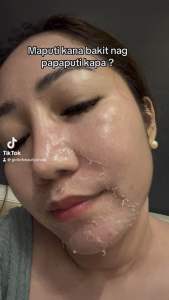 SCD Peeling Skin Lotion Buy 2 with free Kojic Dark Soap