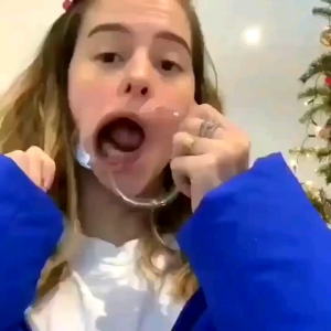 ORI ALAT PEMBUKA MULUT BENTUK C INTRAORAL BIRU CHEEK RETRACTOR PENYANGGA RAHANG GIGI BEHEL MOUTH GAG // Bisa Untuk Anak Dewasa // Elastis Size M L S // Mouth Gate // Mouthgate Original Behelldental