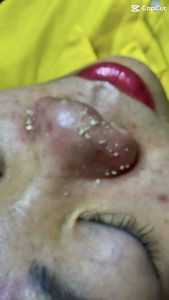 Combo 2 Sản Phẩm Thảo Mộc Thiên Nhiên Thảo Mộc Linh Giúp Tái Tạo Làn Da Mới