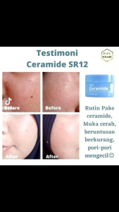 SKINCARE CERAMIDE SKIN BARRIER SR12 CREAM COCOK UNTUK SEMUA JENIS KULIT