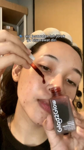 Solusi Peeling Kulit Wajah dengan Glad2glow