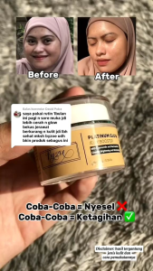 Byzoe Platinum Glow Jelly Booster With Chamomile and Niacinamide Glowing Brightening and Moisturizing merupakan pelembap alami yang bisa membantu mencerahkan kulit serta dapat menjaga kelembapan