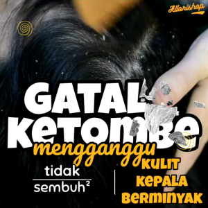 NOVE LOTION RAMBUT ANTI KETOMBE - Menuntaskan Masalah Ketombe Lebih Cepat 50ml