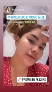 Serum / Serum Jerawat / Acne Insentive Serum Colista Skin Care BPOM