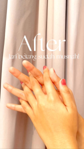 Body Serum Whitening Body Serum Skinsane Pemutih Badan Pencerah Kulit BPOM