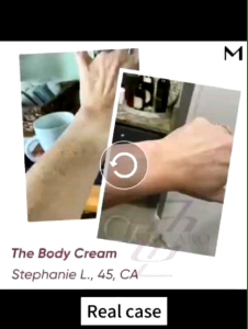 Salorie Blue Light Acne Pen Black Eye Massager Relax Anti Pouch Mencantikkan Hot Sales Instrument Facial Repair Beauty Stick Esthetic