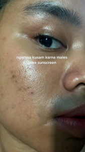 (Ready Free Gift) Reglow Paket Acne | Facial Wash Toner Cream dan Night Cream