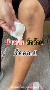 โทนเนอร์ไลยา 1ขวด 195.- ขัดผิว ขจัดขี้ไคลา คอดำ รักแร้ ตาตุ่ม รอยดำ