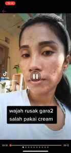 ANZORA ANZORA SKINCARE ANZORA SKINCARE GLOWING ANZORA ACNE ANZORA ACNE DARK SPOT ANZORA SKINCARE ORIGINAL ACNE ANZORA BODY LOTION PERAWATAN WAJAH SKINCARE BERJERAWAT BPOM ANZORA SERUM DNA SALMON SKINCARE ORIGINAL ANZORA GARUT KOTA