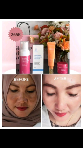 KRIM MALAM RETINYL BG SKIN