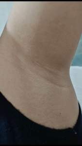 NIACINAMIDE TAWAS SOAP + DEO MIST COMBO