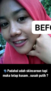 Paket Brightening Orlin Beauty: Solusi Mencerahkan Wajah Susah Putih BPOM