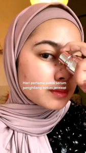 SKINTIFIC - Symwhite 377 Dark Spot Serum 20ml | Niacinamide Serum Mencerahkan Tumpas Komedo Anti-Aging Dark Spot Anti-Acne