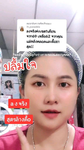 บอสเอส เบตตี้ (เมอเอสพลัส ฟิโอน่า)(เซ็ท1 เดือน) ของแท้