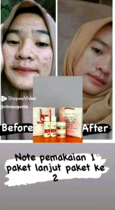 MAXIE SKINCARE PREMIUM TERBARU BPOM