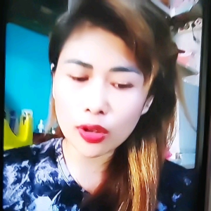 20g CREAM WAJAH whitening blemishe salep melasma salep flek dark spot Whitening n frecle removing Cream